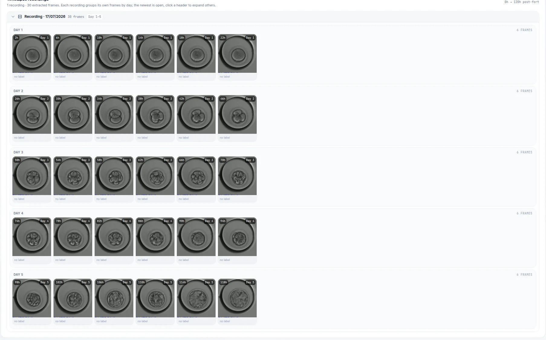 Time-lapse recording in EMBRY broken into thirty extracted frames, grouped into rows by developmental day from Day 1 to Day 5, each frame currently marked as having no label.